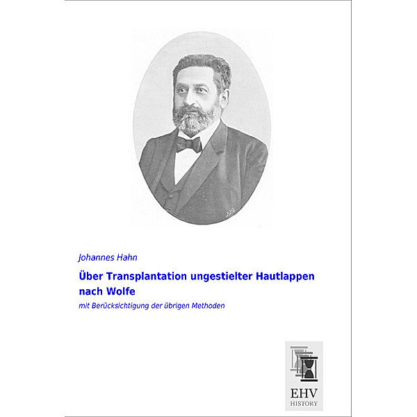 Über Transplantation ungestielter Hautlappen nach Wolfe, Johannes Hahn