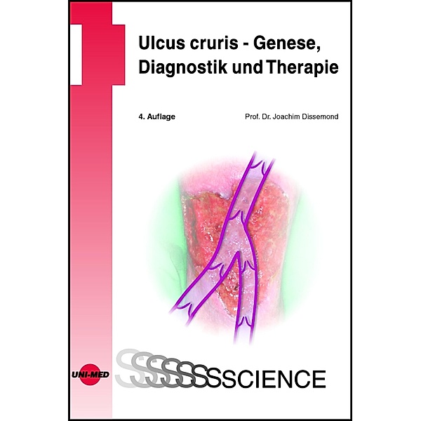 Ulcus cruris - Genese, Diagnostik und Therapie / UNI-MED Science, Joachim Dissemond