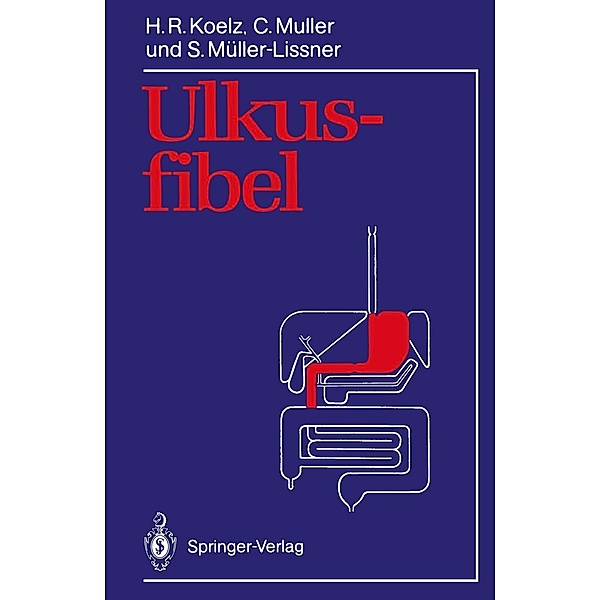 Ulkusfibel, Hans R. Koelz, Claude Muller, Stefan Müller-Lissner