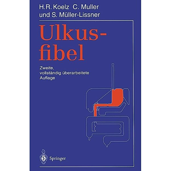 Ulkusfibel, Hans R. Koelz, Claude Muller, Stefan Müller-Lissner