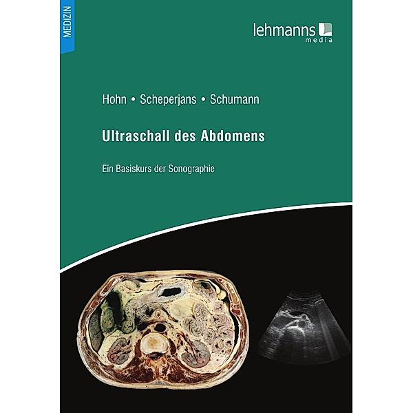 Ultraschall des Abdomens