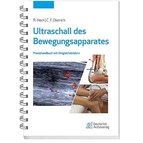 Ultraschall des Bewegungsapparates, Rudolf Horn, Christoph F. Dietrich