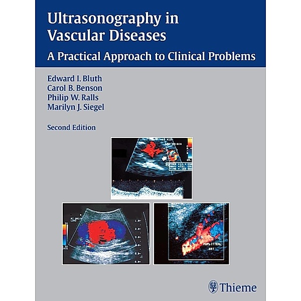 Ultrasonography in Vascular Diseases, Edward I. Bluth, Carol B. Benson, Philip W. Ralls, Marilyn J. Siegel