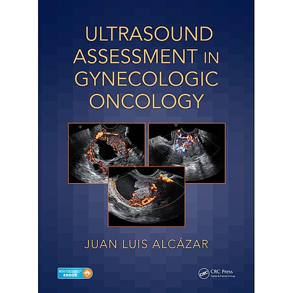 Ultrasound Assessment in Gynecologic Oncology, Juan Luis Alcázar