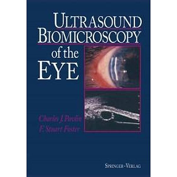 Ultrasound Biomicroscopy of the Eye, Charles J. Pavlin, F. Stuart Foster