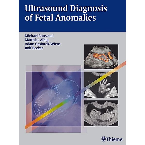 Ultrasound Diagnosis of Fetal Anomalies