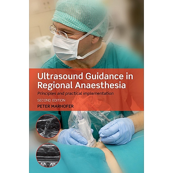 Ultrasound Guidance in Regional Anaesthesia, Peter Marhofer
