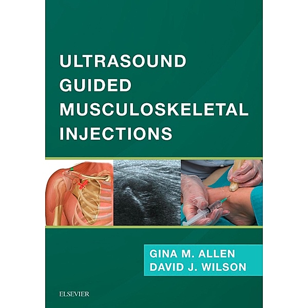 Ultrasound Guided Musculoskeletal Injections E-Book, Gina M Allen, David John Wilson
