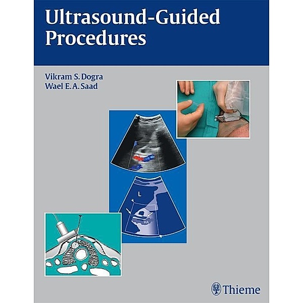 Ultrasound-Guided Procedures, Vikram S. Dogra, Wael E. A. Saad