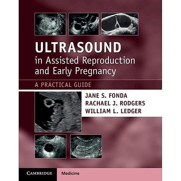 Ultrasound in Assisted Reproduction and Early Pregnancy, Jane S. Fonda