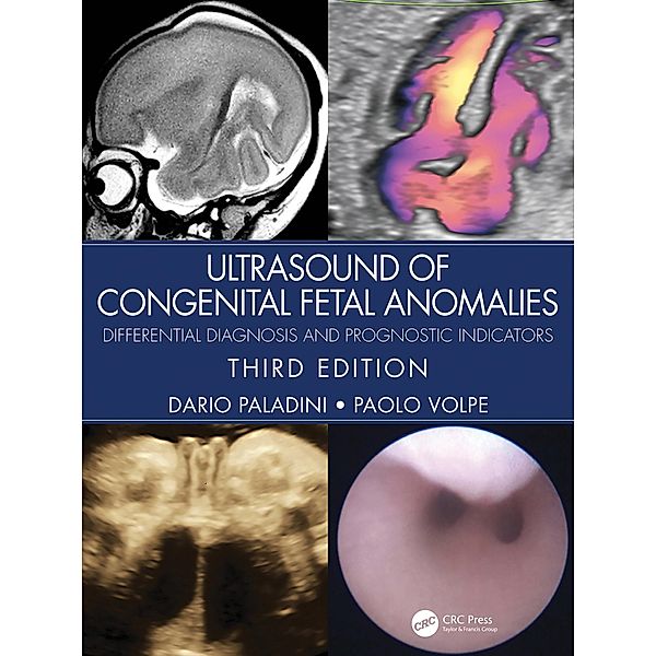 Ultrasound of Congenital Fetal Anomalies, Dario Paladini, Paolo Volpe