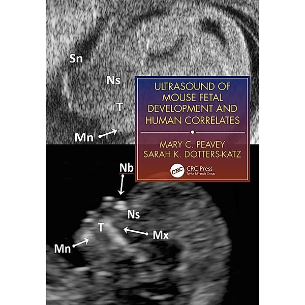 Ultrasound of Mouse Fetal Development and Human Correlates, Mary C. Peavey, Sarah K. Dotters-Katz