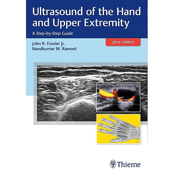 Ultrasound of the Hand and Upper Extremity