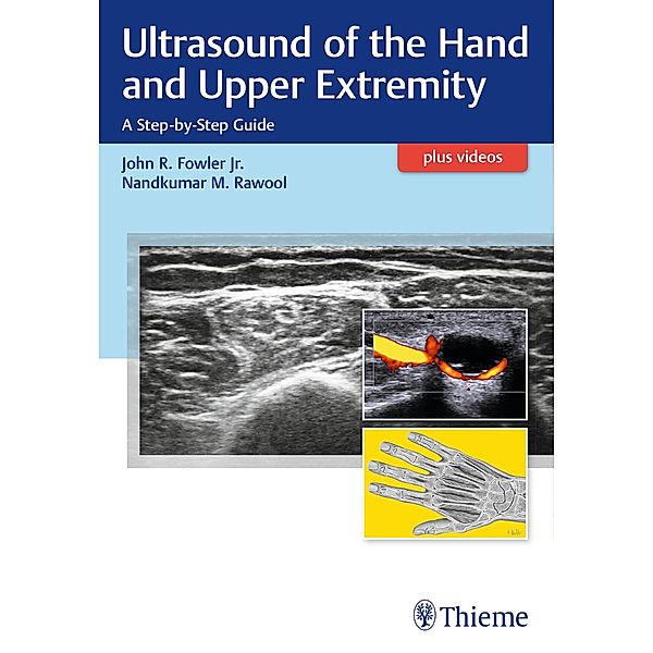 Ultrasound of the Hand and Upper Extremity