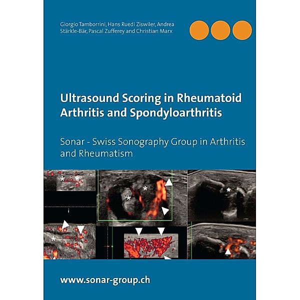 Ultrasound Scoring in Rheumatoid Arthritis and Spondyloarthritis, Hans Ruedi Ziswiler, Giorgio Tamborrini, Andrea Stärkle-Bär, Christian Marx, Pascal Zufferey