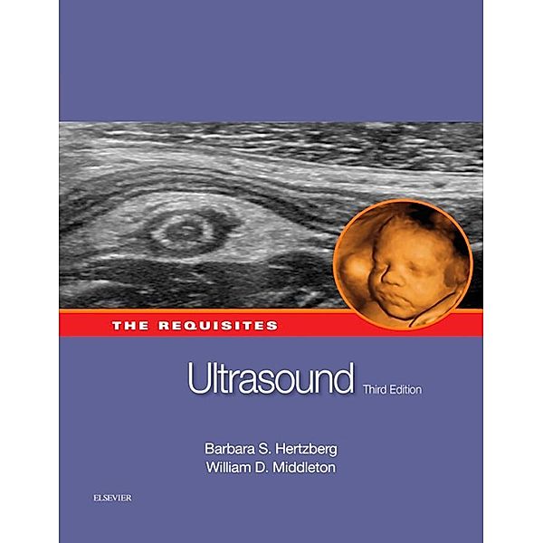 Ultrasound: The Requisites E-Book, William D. Middleton, Tara Morgan