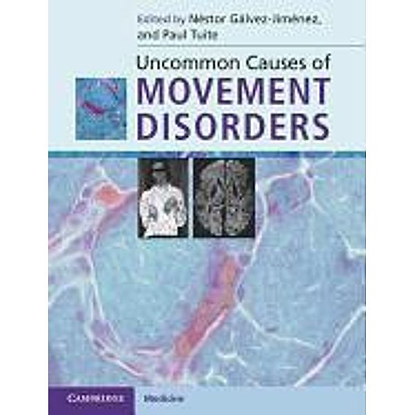 Uncommon Causes of Movement Disorders, Néstor Gálvez-Jiménez, Paul J. Tuite