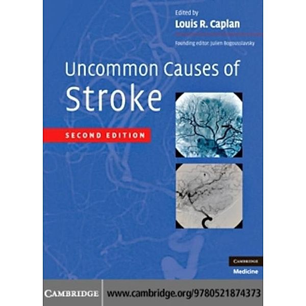 Uncommon Causes of Stroke