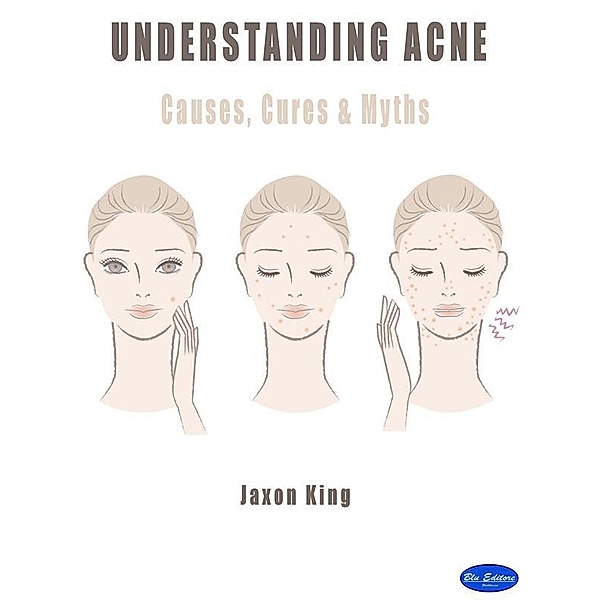 Understanding Acne, Jaxon King