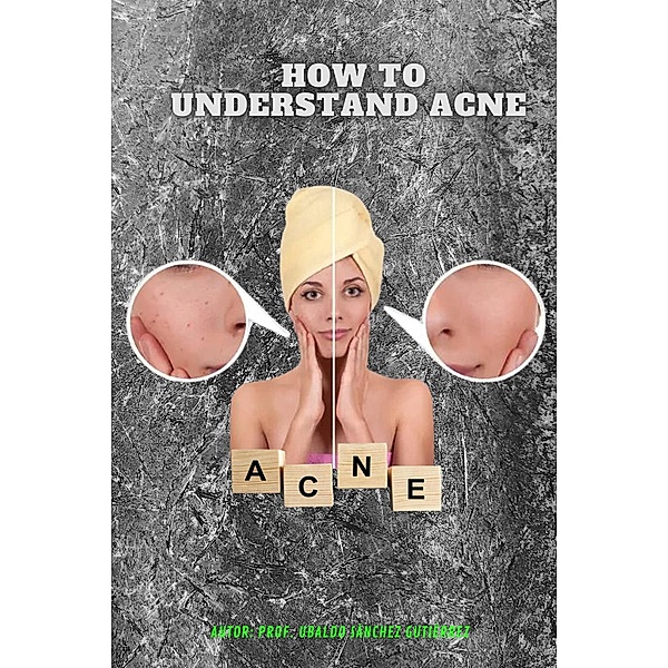 Understanding acne, Ubaldo73, Ubaldo Sánchez Gutiérrez