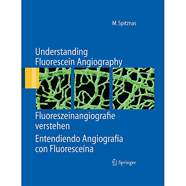 Understanding Fluorescein Angiography, Fluoreszeinangiografie verstehen, Entendiendo Angiografía con Fluoresceína, Manfred Spitznas