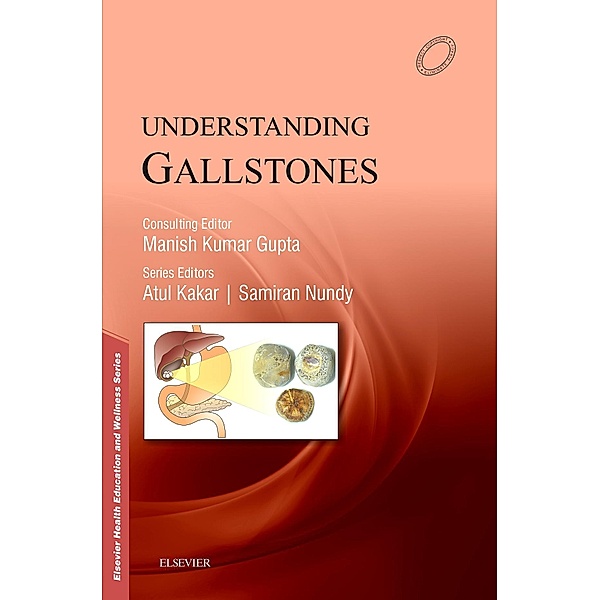 Understanding Gallstones - E-Book