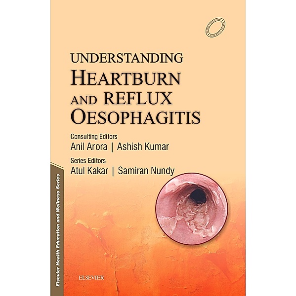 Understanding Heartburn and Reflux Oesophagitis - e-Book, Samiran Nundy