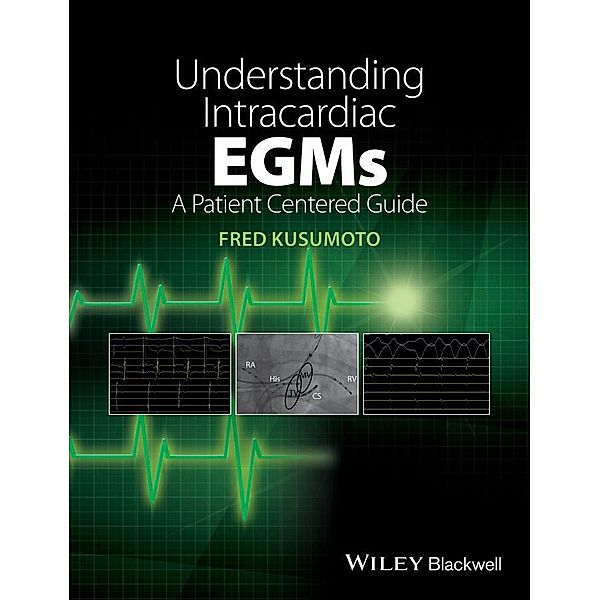 Understanding Intracardiac EGMs, Fred Kusumoto