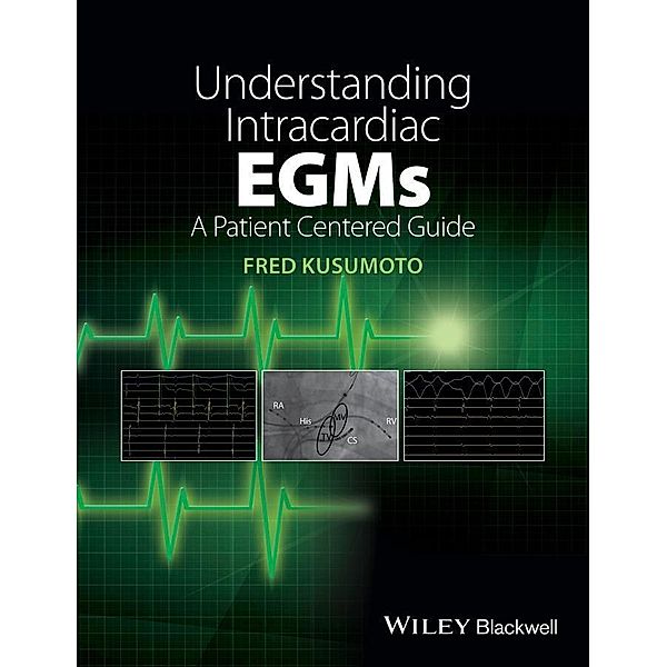 Understanding Intracardiac EGMs, Fred Kusumoto