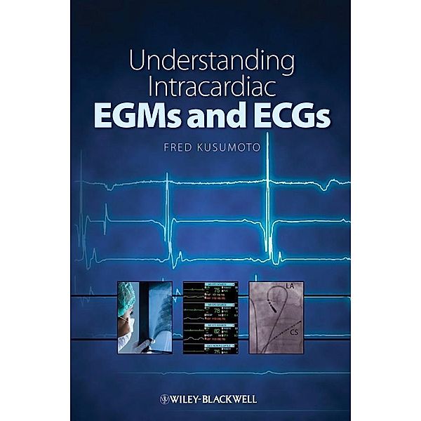 Understanding Intracardiac EGMs and ECGs, Fred Kusumoto