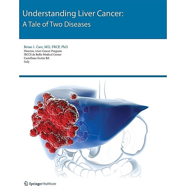 Understanding Liver Cancer, Brian I. Carr