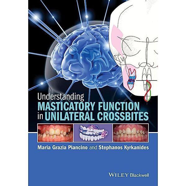 Understanding Masticatory Function in Unilateral Crossbites, Maria Grazia Piancino, Stephanos Kyrkanides