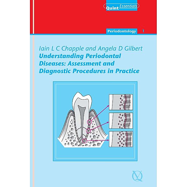 Understanding Periodontal Diseases: Assessment and Diagnostic Procedures in Practice / QuintEssentials of Dental Practice Bd.1, Iain L. C. Chapple, Angela Gilbert