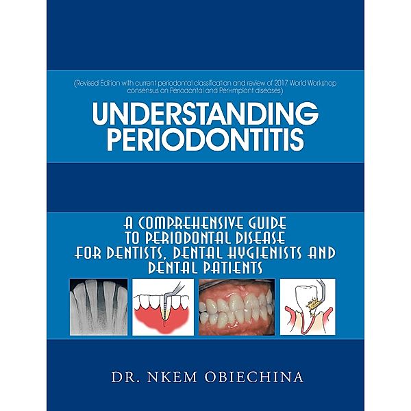 Understanding Periodontitis, Nkem Obiechina
