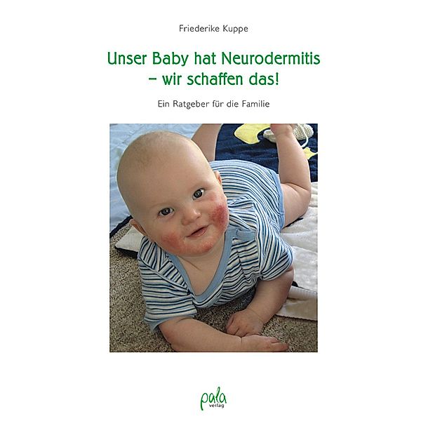 Unser Baby hat Neurodermitis - wir schaffen das!, Friederike Kuppe