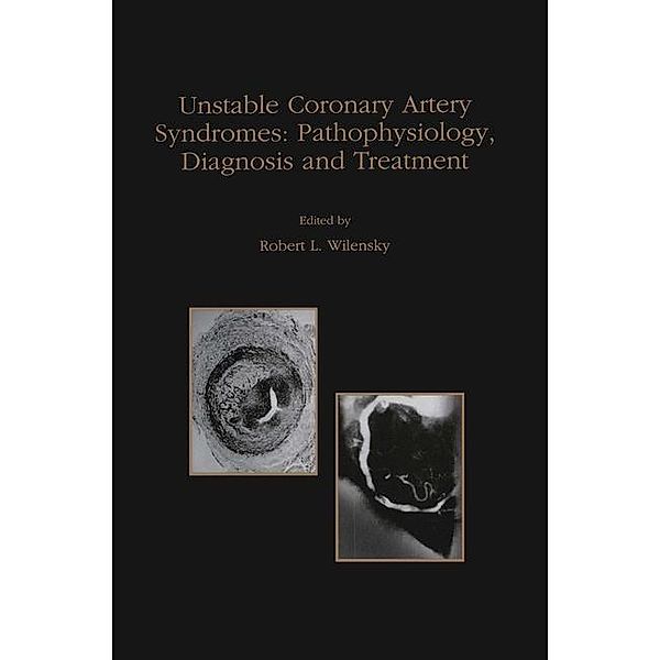 Unstable Coronary Artery Syndromes Pathophysiology, Diagnosis and Treatment / Developments in Cardiovascular Medicine Bd.203, Robert L. Wilensky