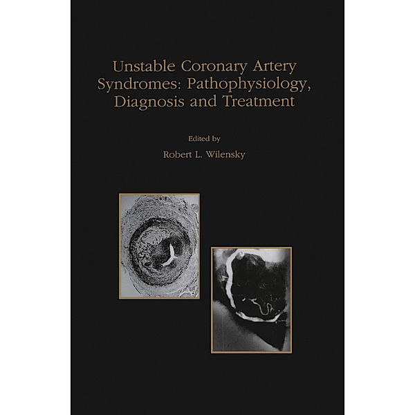 Unstable Coronary Artery Syndromes Pathophysiology, Diagnosis and Treatment, Robert L. Wilensky