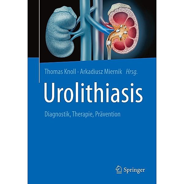 Urolithiasis