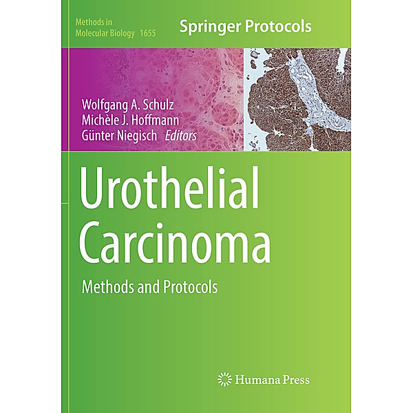 Urothelial Carcinoma