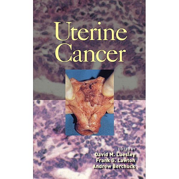 Uterine Cancer