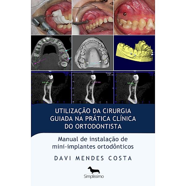 Utilização da cirurgia guiada na prática clínica do ortodontista, Davi Mendes Costa