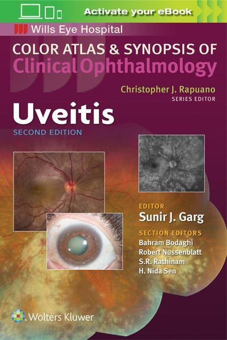 Uveitis Color Atlas And Synopsis Of Clinical Ophthalmology Buch