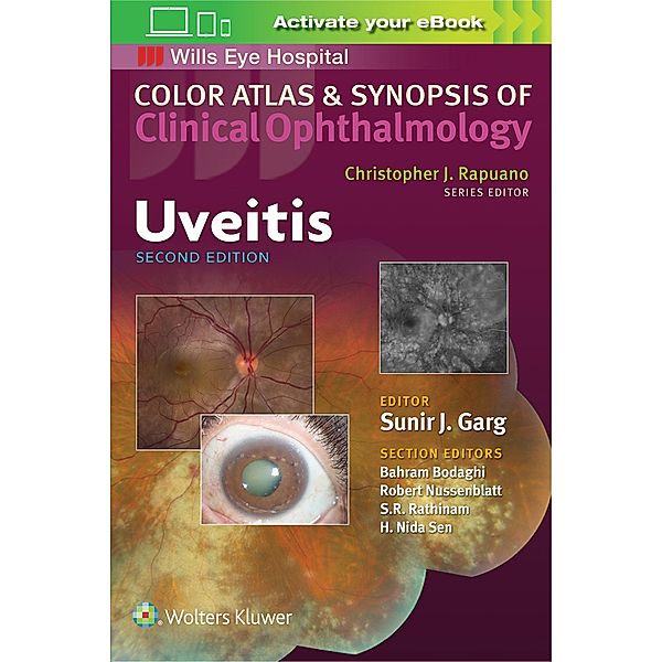 Uveitis (Color Atlas and Synopsis of Clinical Ophthalmology), Sunir Garg