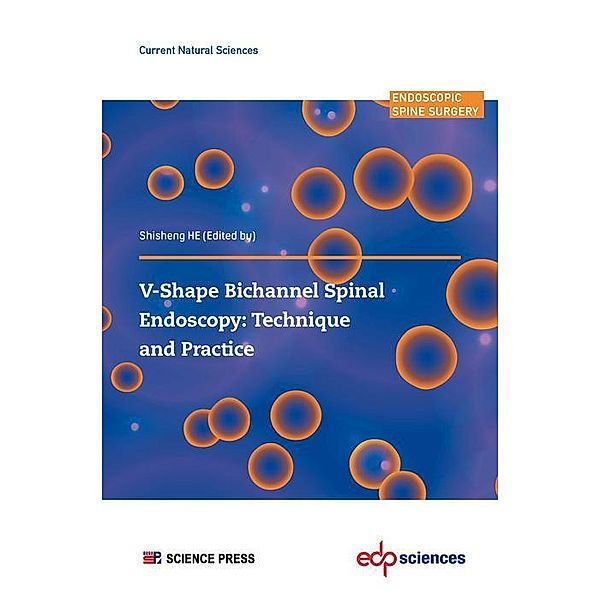V-Shape Bichannel Spinal Endoscopy: Technique and Practice