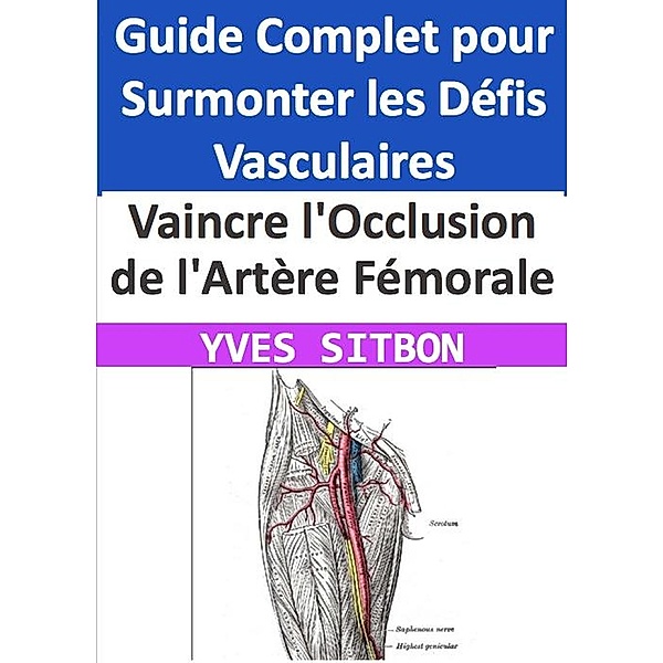 Vaincre l'Occlusion de l'Artère Fémorale : Guide Complet pour Surmonter les Défis Vasculaires, Yves Sitbon