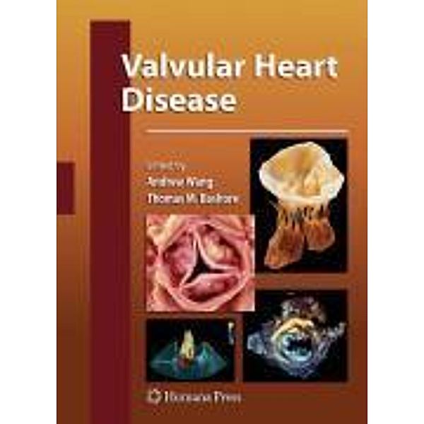 Valvular Heart Disease / Contemporary Cardiology
