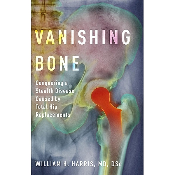 Vanishing Bone, William H. MD Harris