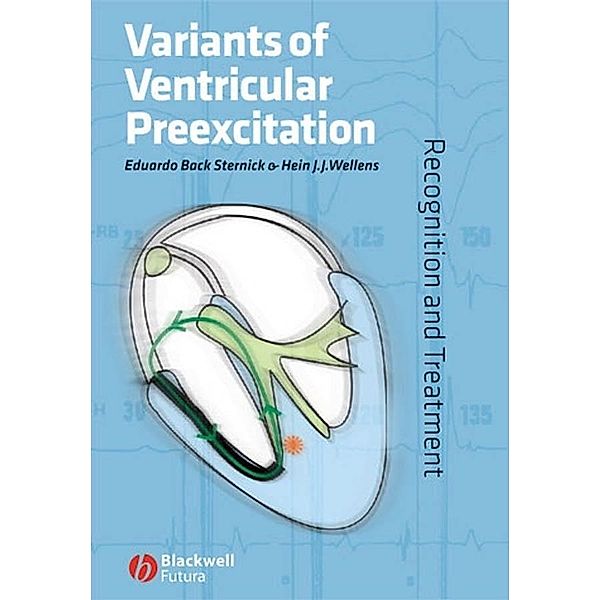Variants of Ventricular Preexcitation, Eduardo Back Sternick, Hein J. J. Wellens