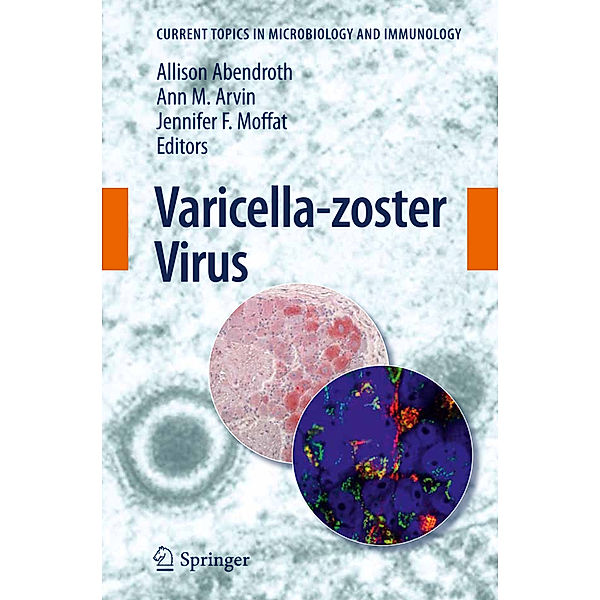 Varicella-zoster Virus