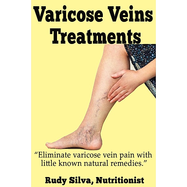 Varicose Vein Treatments, Rudy Silva